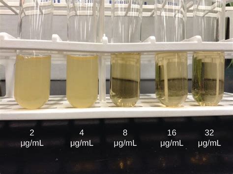 10 5 Testing The Effectiveness Of Antimicrobials Allied Health