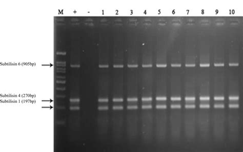 Gel electrophoresis results of multiplex PCR with 4 pairs of primers... | Download Scientific ...