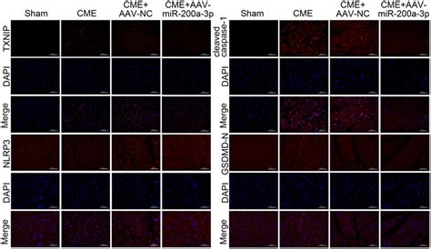 Immunofluorescence Staining Of TXNIP NLRP3 Cleaved Caspase 1 And