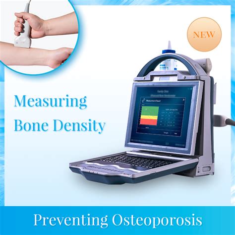 China Bmd A3 Ultrasound Bone Mineral Densitometer For Bone Density