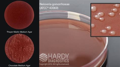 Modified Thayer Martin Agar - Composition, Preparation, and Principle ...