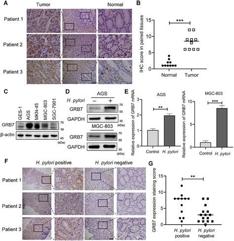 Frontiers Grb7 Mediated Enhancement Of Cell Malignant Characteristics