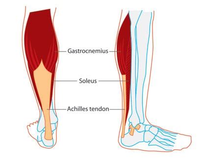 Calf Muscle Cramps - Active Care Podiatry