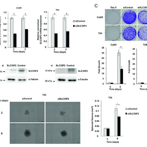 MRNA Expression Analysis Of SLC35F2 In Tumour Samples And Bladder