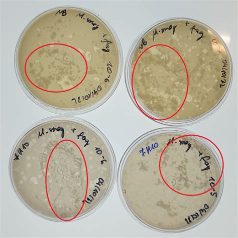 Mycobacteriophage plaque assay procedure? | ResearchGate