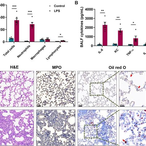 Lipid Accumulation In Pulmonary Macrophages Increased In A