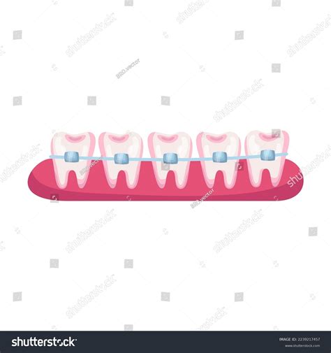 Teeth Before Braces Cartoon Illustration Stage Stock Vector (Royalty ...