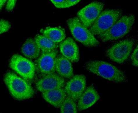 Calreticulin Monoclonal Antibody 7b1 Ma5 45067