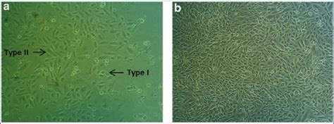 Morphology Of Urine Stem Cells USCs Obtained From Fresh Duchenne