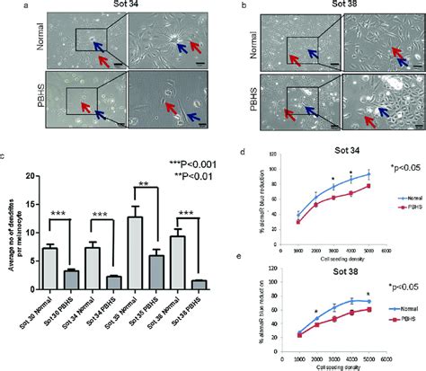 Co Culture Of Keratinocytes And Melanocytes From Normal And PBHS