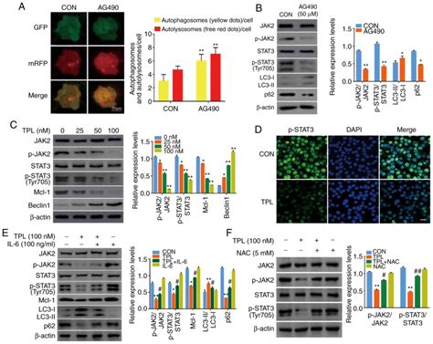 Triptolide Inhibits JAK2 STAT3 Signaling And Induces Lethal Autophagy