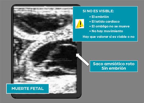 Atlas De Ecograf As En Ganado Vacuno Diagn Stico Gestaci N Muerte