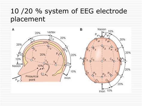 Ppt Electroencephalography Eeg Powerpoint Presentation Free