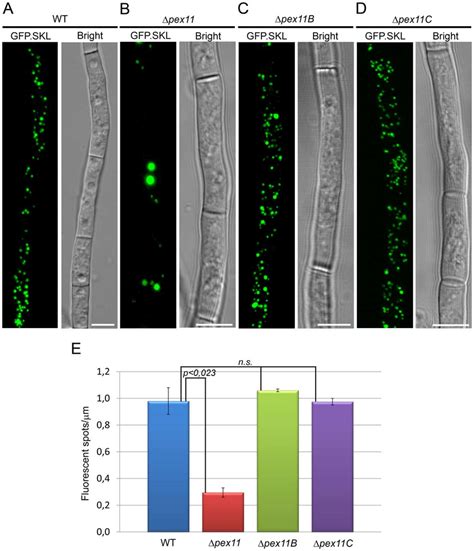 Impact of deletion of individual Pex11 family genes on peroxisome ... 