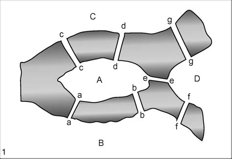 Ponti Di Konigsberg Problema Dei Enciclopedia Treccani