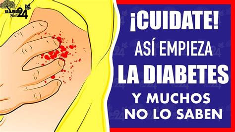 ⚕️si Tienes 1 De Estos Sintomas Puede Ser Inicio De Diabetes Y No Te