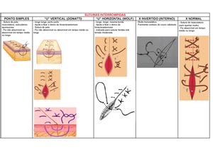 Tipos De Sutura Tipos De Sutura Descreva Os Principais Tipos De