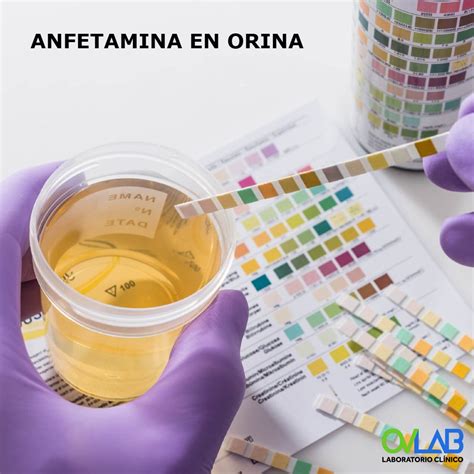 ANFETAMINA EN ORINA OVLAB O V Laboratorios