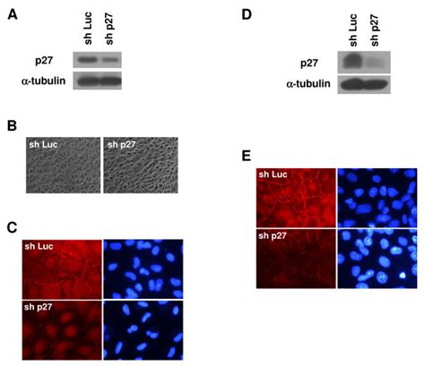 Knockdown Of P Disrupts Vhl Mediated Tight Junction Formation A