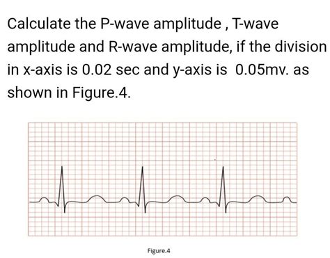 Solved Calculate the P-wave amplitude , T-wave amplitude and | Chegg.com