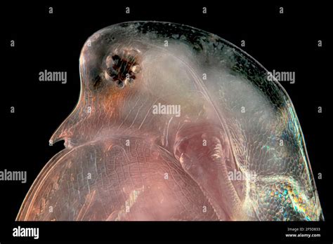 Common Water Flea Daphnia Pulex Head Of A Water Flea Dark Field