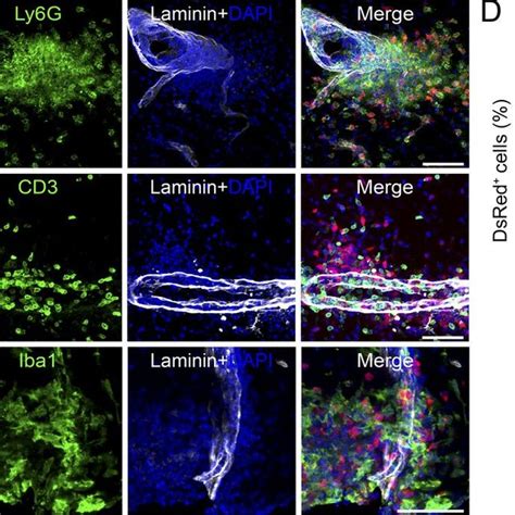 Il 1β Is Mainly Expressed By Neutrophils And Macrophages That