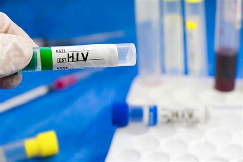 Anvisa Aprova Novo Medicamento Para Preven O Do Hiv