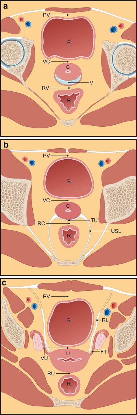 Axial Cross Sectional Illustration Through The Female Pelvis Depicting