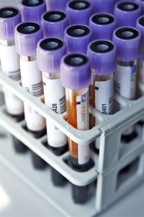 Rack With Test Tubes Of Blood Stock Image Image Of Equipment