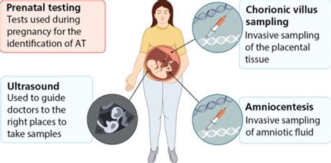 Alpha Thalassemia: Screening and Diagnosis - The Waiting Room