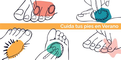 Tips De Cuidado De Pies En Verano Inforgraf A Blog Iberomed