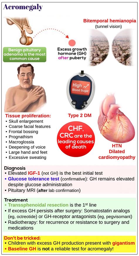 Acromegaly Medicine Keys For Mrcps