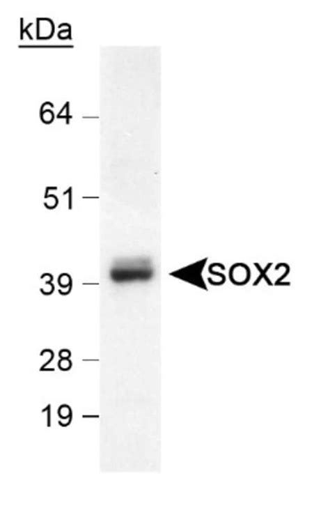 Sox Antibody Bsa Free Novus Biologicals Ml Unlabeled