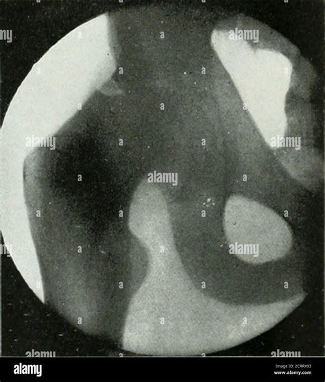 The American Journal Of Roentgenology Radium Therapy And Nuclear