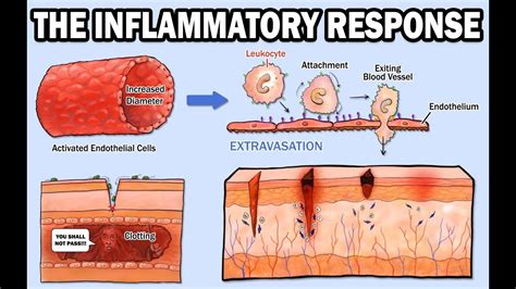 Inflammatory Response Diagram