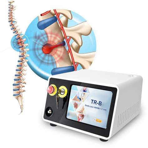 Triangelaser Hot Sale Lumbar Disk Therapy Diode 980nm 1470nm Pldd Laser