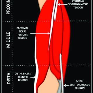 Schematic Diagram To Demonstrate The Sequential Axial Anatomy Of The