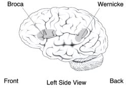 Wernicke's area Facts for Kids