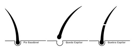 Entenda a diferença entre quebra e queda de cabelo Cabelos Poderosos