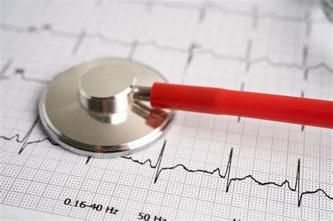 Stéthoscope Sur électrocardiogramme Ecg Onde Cardiaque Rapport De