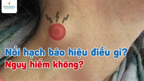 Nổi hạch báo hiệu điều gì Nguy hiểm không YouTube