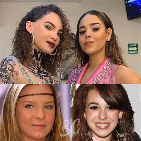 Antes Y Después Evidencian Las Cirugías Estéticas De Belinda Y Danna