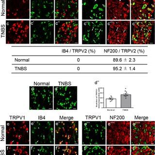 The TNBS Treatment Increased The TRPV2 And TRPV1 Expressions But Did