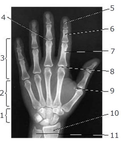 RADT 100 Module 2 1 4 Self Assessment Hand And Wrist Anatomy