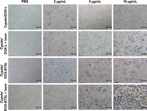 Trypan Blue Staining Image Of McF 7 Cells Treated With PBs