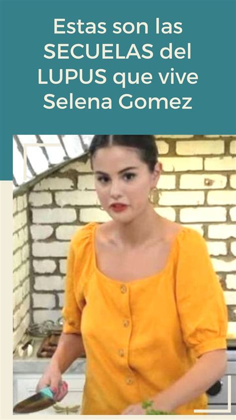 Estas Son Las Secuelas Del Lupus Que Vive Selena Gomez Artofit