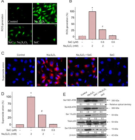 Selenocysteine SeC Attenuates Oxygen Glucose Deprivation