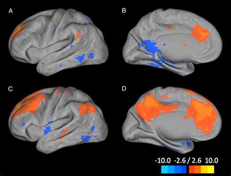 Resting State Functional Mri In Depression Unmasks Increased