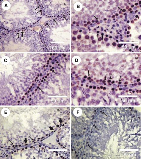 Photomicrographs Of Rat Testes Sections In Different Groups Under Study