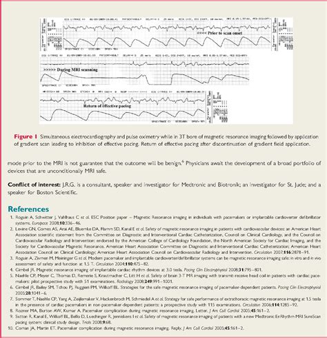 Figure From Unexpected Asystole During T Magnetic Resonance Imaging